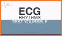 ECG FlashCards 2 - Reference App Most common EKGs related image