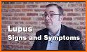 Lupus: Causes, Diagnosis, and Treatment related image