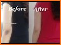 Get Rid Of Dark Knees And Elbows Fast & Naturally related image